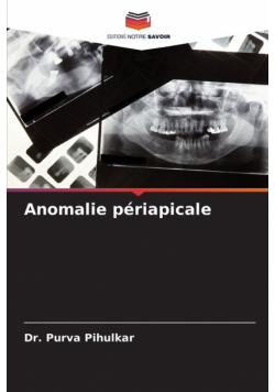Anomalie périapicale