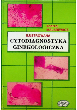 Cytodiagnostyka ginekologiczna