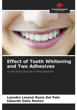 Effect of Tooth Whitening and Two Adhesives