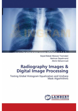 Radiography Images & Digital Image Processing