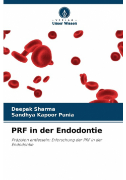 PRF in der Endodontie