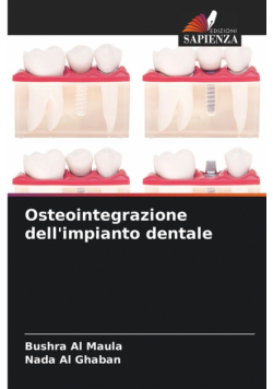 Osteointegrazione dell'impianto dentale