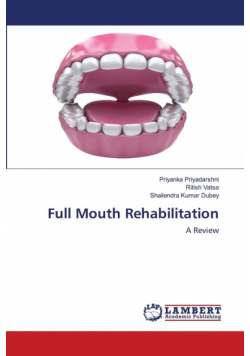 Full Mouth Rehabilitation