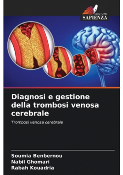 Diagnosi e gestione della trombosi venosa cerebrale