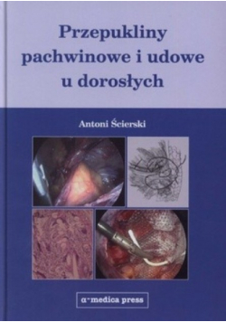 Przepukliny pachwinowe i udowe u dorosłych