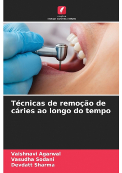 Técnicas de remoção de cáries ao longo do tempo
