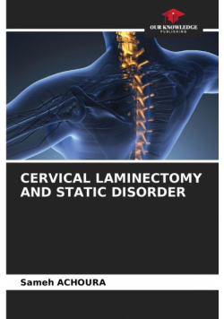 Cervical Laminectomy And Static Disorder