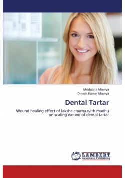 Dental Tartar