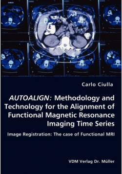 Autoalign