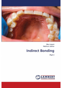 Indirect Bonding