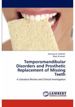 Temporomandibular Disorders and Prosthetic Replacement of Missing Teeth