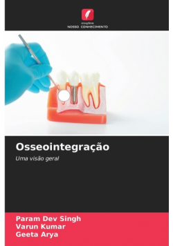 Osseointegração