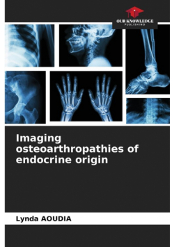 Imaging osteoarthropathies of endocrine origin