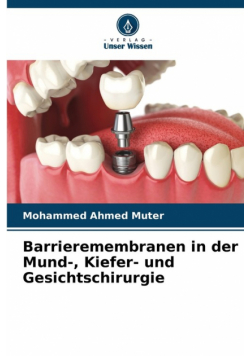 Barrieremembranen in der Mund-, Kiefer- und Gesichtschirurgie