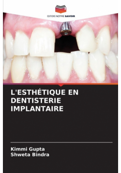 L'esthétique En Dentisterie Implantaire