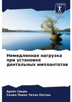 Немедленная нагрузка при установке дентальных имплантатов