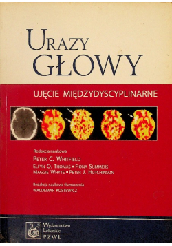 Urazy głowy