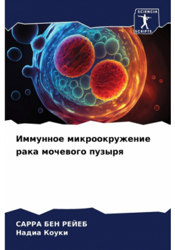 Иммунное микроокружение рака мочевого пузыря