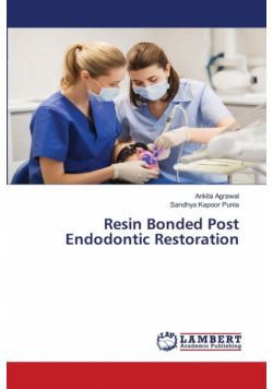Resin Bonded Post Endodontic Restoration