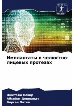 Имплантаты в челюстно-лицевых протезах
