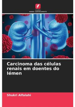 Carcinoma das células renais em doentes do Iémen