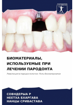 БИОМАТЕРИАЛЫ, ИСПОЛЬЗУЕМЫЕ ПРИ ЛЕЧЕНИИ ПАРОДОНТА