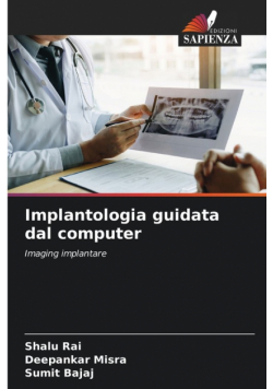 Implantologia guidata dal computer