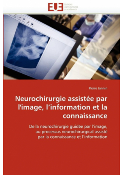 Neurochirurgie assistée par l''image, l''information et la connaissance