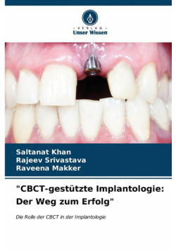 "CBCT-gestützte Implantologie