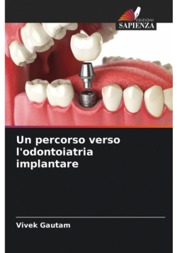 Un percorso verso l'odontoiatria implantare