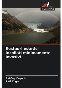 Restauri estetici incollati minimamente invasivi