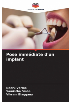 Pose immédiate d'un implant