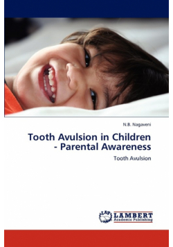 Tooth Avulsion in Children - Parental Awareness