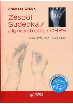 Zespół Sudecka / Algodystrofia / CRPS
