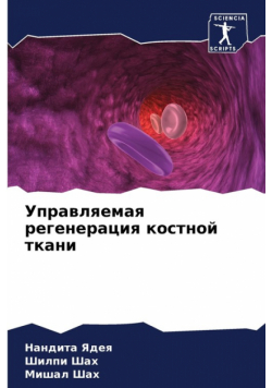 Управляемая регенерация костной ткани