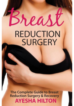 Breast Reduction Surgery