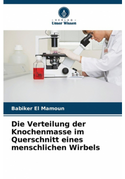 Die Verteilung der Knochenmasse im Querschnitt eines menschlichen Wirbels