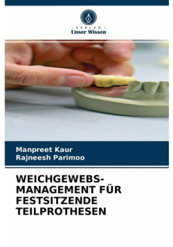 Weichgewebs- Management Für Festsitzende Teilprothesen