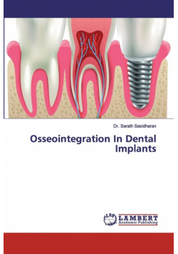 Osseointegration In Dental Implants