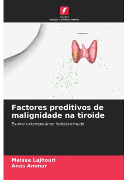Factores preditivos de malignidade na tiroide