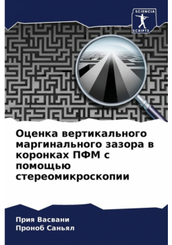 Оценка вертикального маргинального зазора в коронках ПФМ с помощью стереомикроскопии