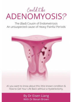 Adenomyosis -The Bad Cousin of Endometriosis