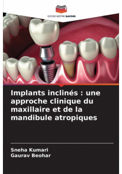 Implants inclinés