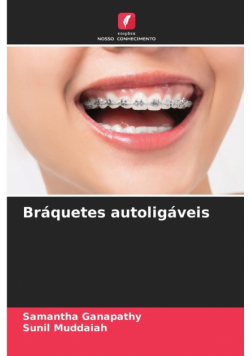 Bráquetes autoligáveis
