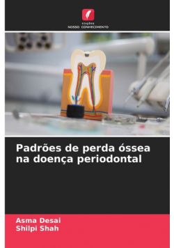 Padrões de perda óssea na doença periodontal