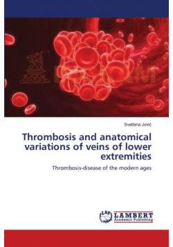 Thrombosis and anatomical variations of veins of lower extremities