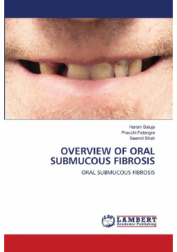 Overview Of Oral Submucous Fibrosis