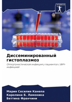 Диссеминированный гистоплазмоз