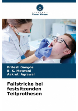 Fallstricke bei festsitzenden Teilprothesen