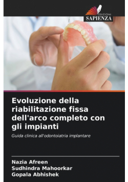 Evoluzione della riabilitazione fissa dell'arco completo con gli impianti